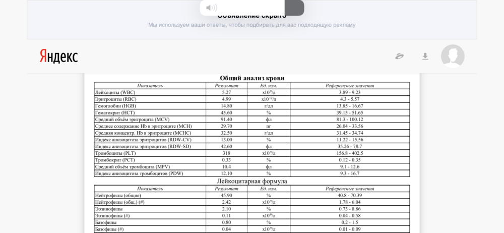 6ACA174E-160B-4701-A226-11B0CDE256AB.png